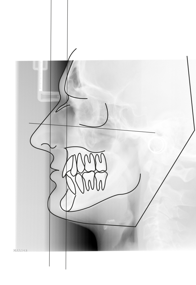 Chirurgien spécialisé en stomatologie et chirurgie maxillo-faciale à l’hôpital CHIREC de Braine l’Alleud et au CHU Brugmann.